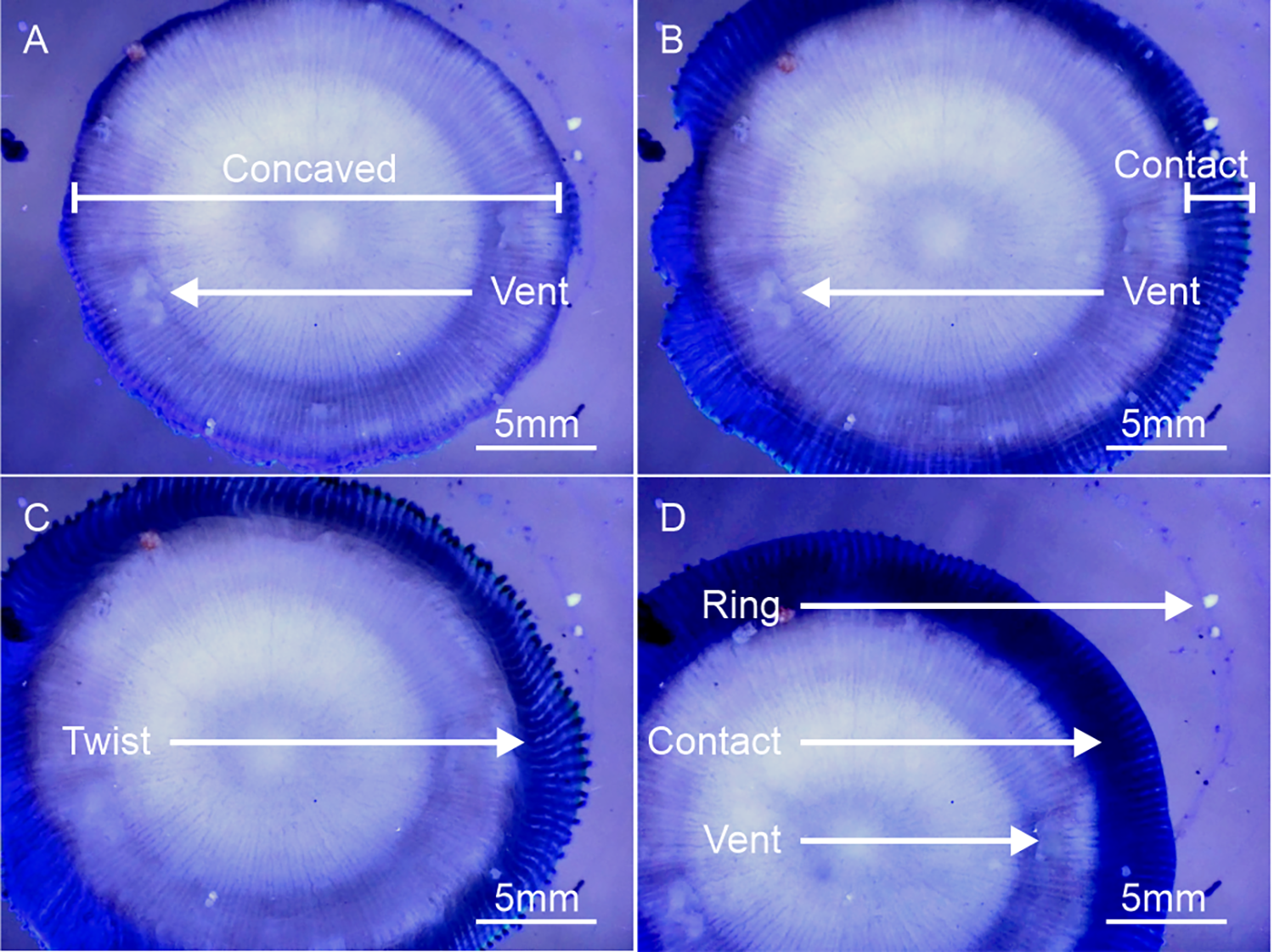 Four microscope panels show the coral underside, widening rim contact, twisting tissue and a residual ring
